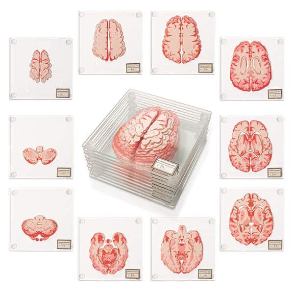 graduation gifts for medical students: Anatomic Brain Specimen Coasters