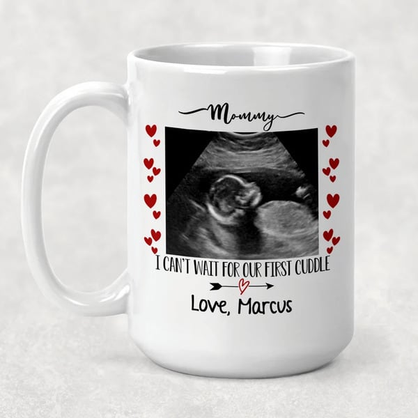 Ultrasound Picture Hearts frame
